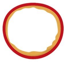 Arterieller Teil der Kapillare