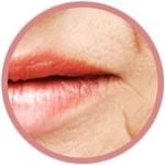 Lippenkontur-volumen
